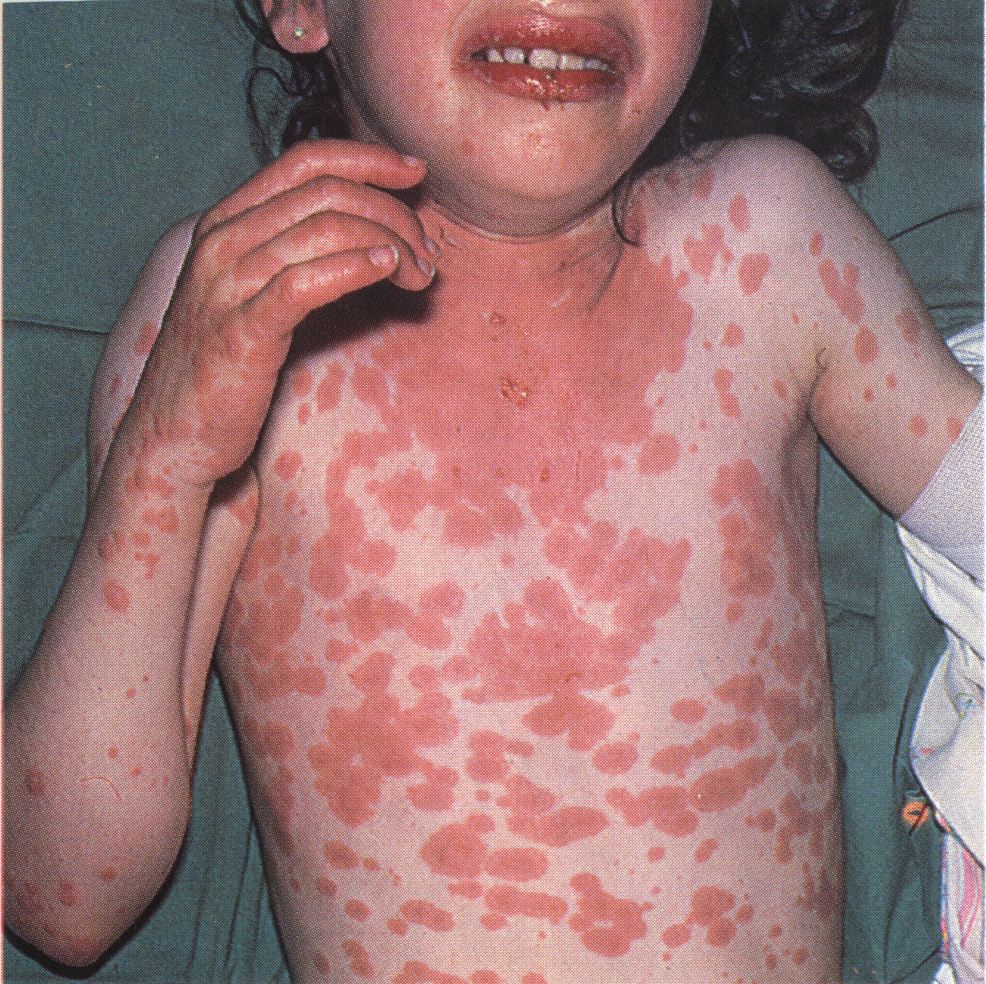 Daignostic Picture Tests in Clinical Medicine 360