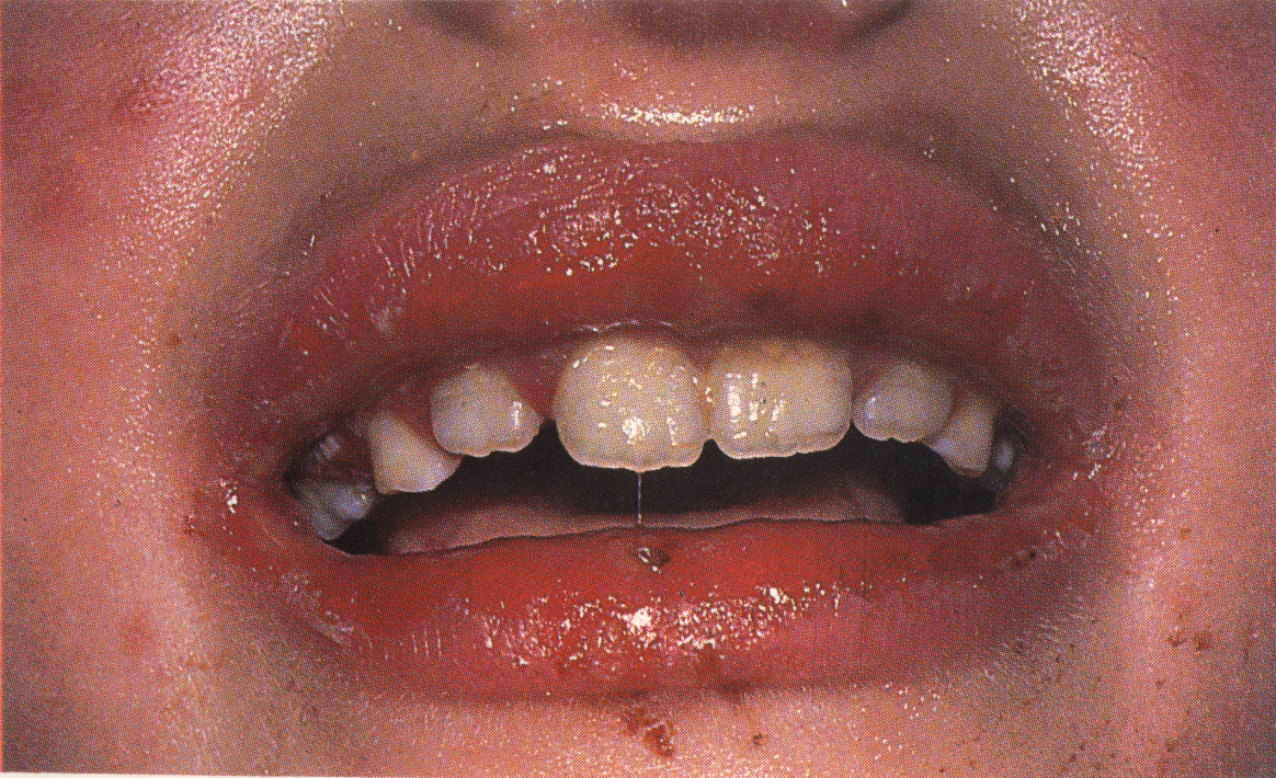Daignostic Picture Tests in Clinical Medicine 361